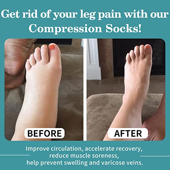 3 Pair Knee High for Varicose Veins, Anti Fatigue, Pain Relief Compression Stockings